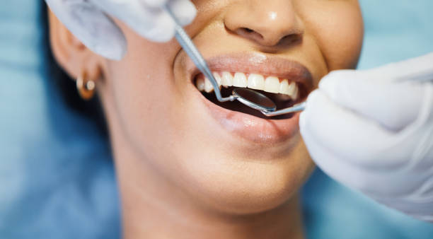 Best Tooth Pain Emergency Relief  in Bluffton, OH
