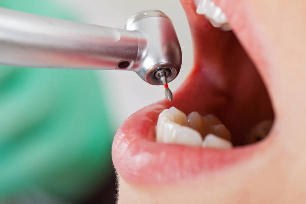 Best Cracked Tooth Emergency Dentist  in Bluffton, OH